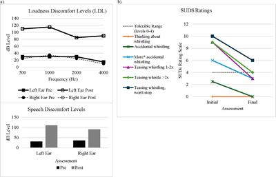 Modified cognitive behavioral therapy approach reduces loudness discomfort levels for an autistic child with hyperacusis: case report